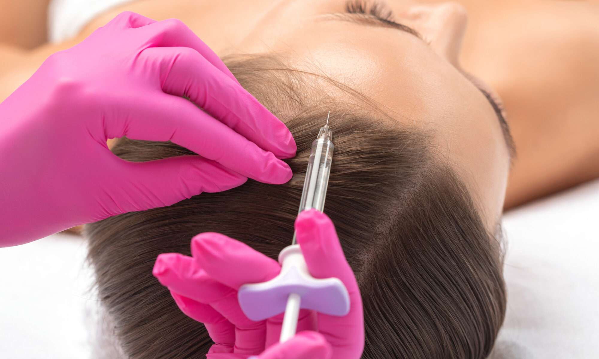 PRP Haarwachstum Düsseldorf