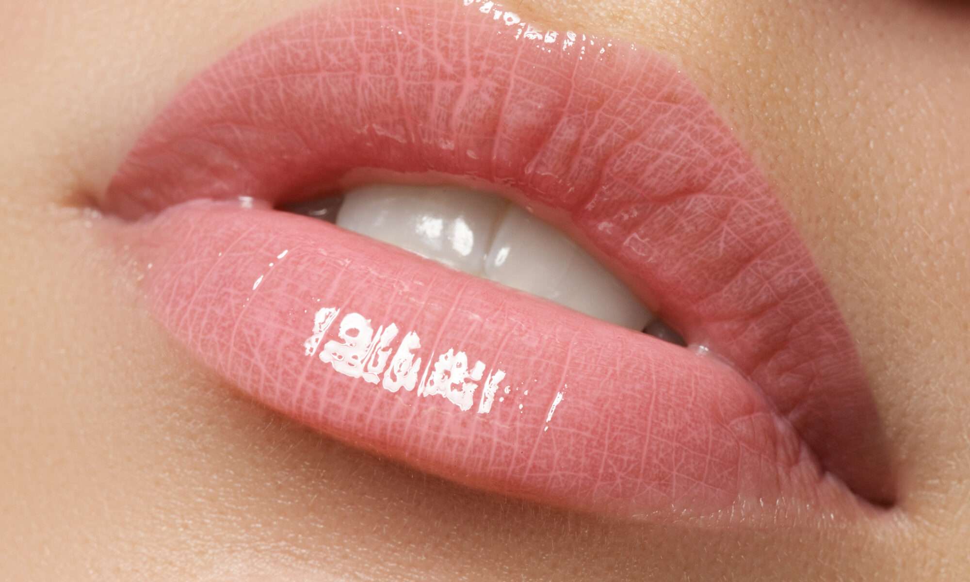 Lippen aufspritzen Düsseldorf