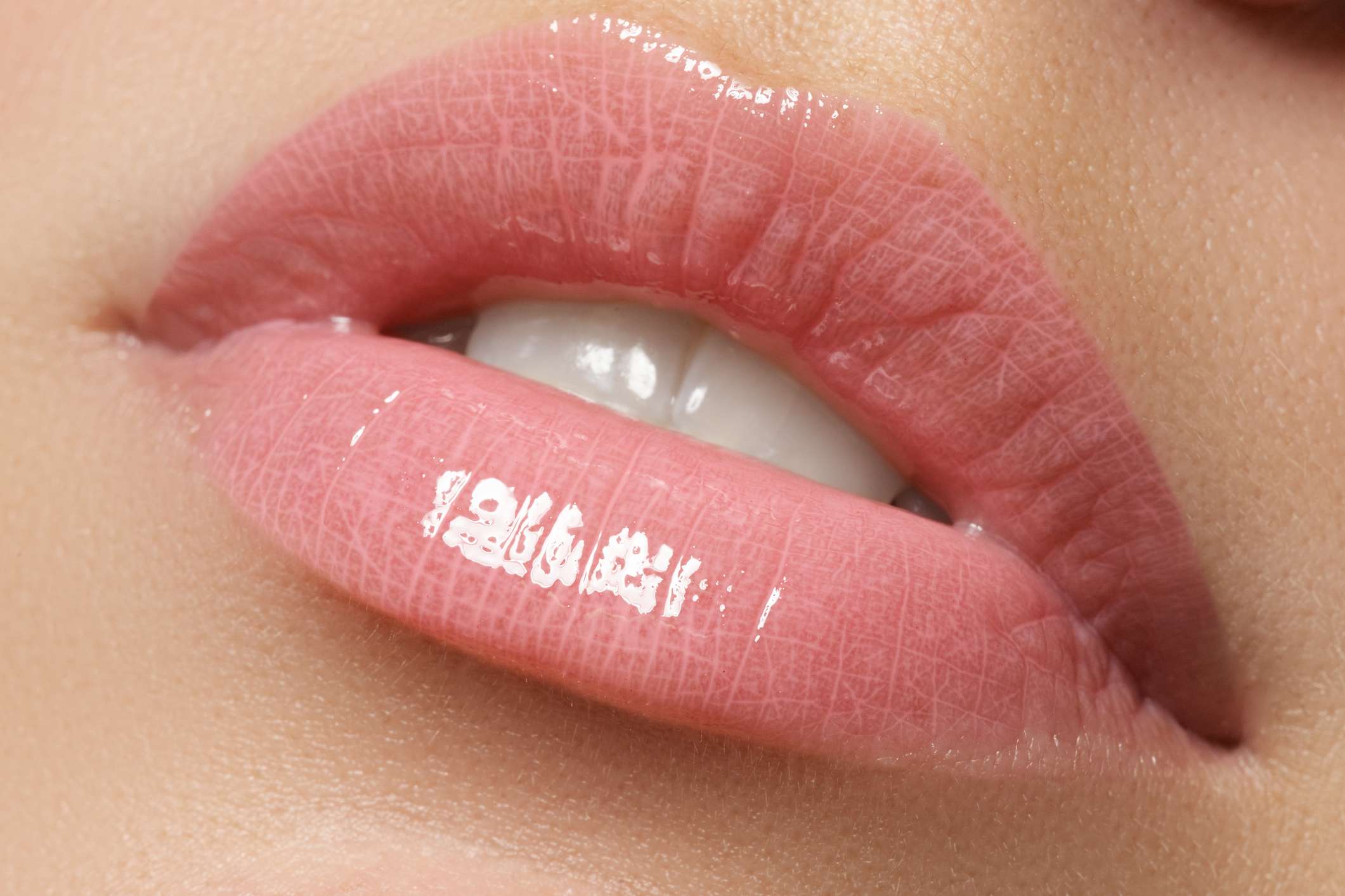 Lippen aufspritzen Düsseldorf